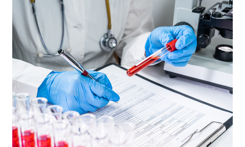 Ferrytyna – czym jest? I o czym może świadczyć jej nadmiar orazniedobór?